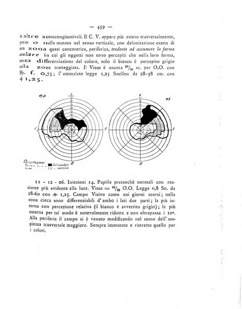 Annali di ottalmologia