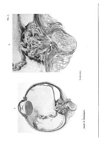 Annali di ottalmologia