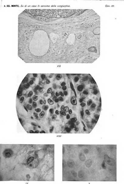 Annali di ottalmologia