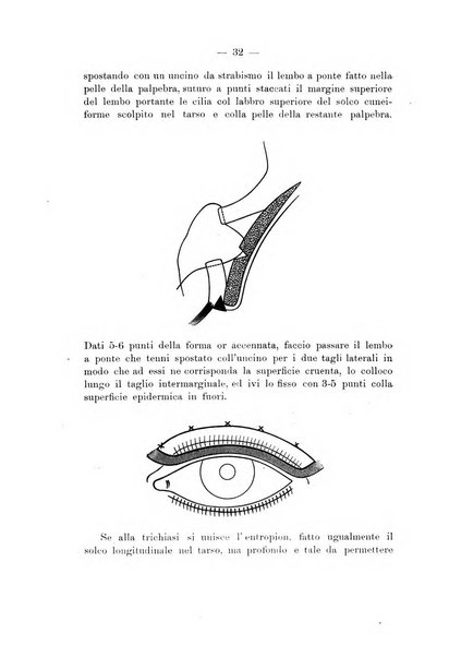 Annali di ottalmologia