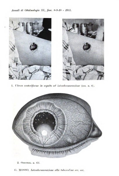 Annali di ottalmologia