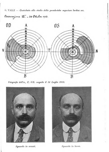 Annali di ottalmologia