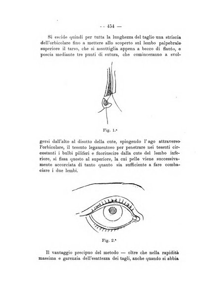 Annali di ottalmologia