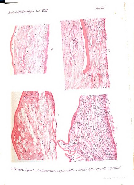 Annali di ottalmologia