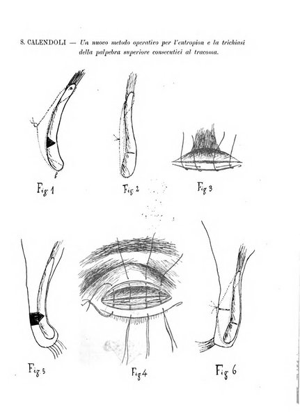 Annali di ottalmologia