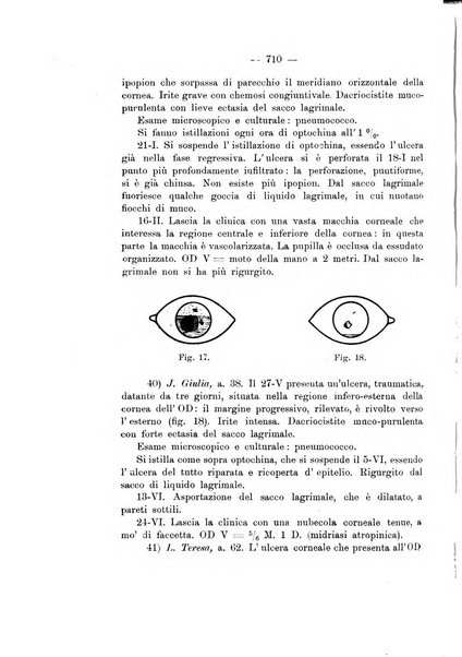 Annali di ottalmologia