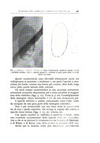 giornale/TO00175354/1938/unico/00000389