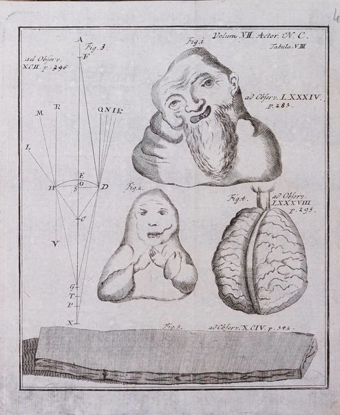 Acta physico-medica Academiae caesareae leopoldino-carolinae naturae curiosorum exhibentia ephemerides sive oservationes historias et experimenta a celeberrimis Germaniae et exterarum regionum viris habita et communicata..