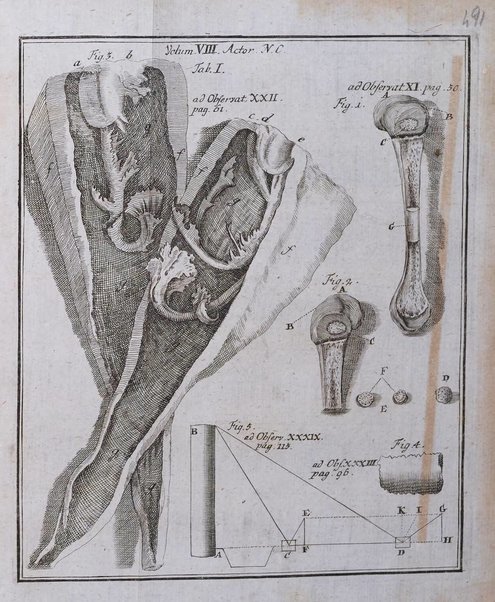 Acta physico-medica Academiae caesareae leopoldino-carolinae naturae curiosorum exhibentia ephemerides sive oservationes historias et experimenta a celeberrimis Germaniae et exterarum regionum viris habita et communicata..