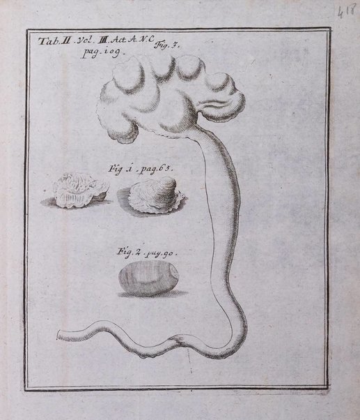 Acta physico-medica Academiae caesareae leopoldino-carolinae naturae curiosorum exhibentia ephemerides sive oservationes historias et experimenta a celeberrimis Germaniae et exterarum regionum viris habita et communicata..