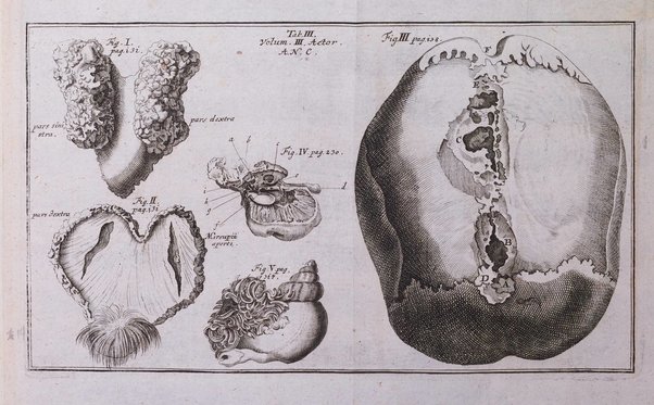 Acta physico-medica Academiae caesareae leopoldino-carolinae naturae curiosorum exhibentia ephemerides sive oservationes historias et experimenta a celeberrimis Germaniae et exterarum regionum viris habita et communicata..