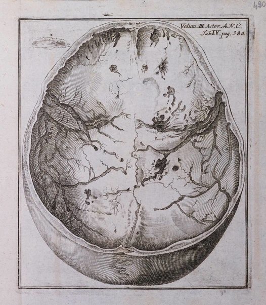 Acta physico-medica Academiae caesareae leopoldino-carolinae naturae curiosorum exhibentia ephemerides sive oservationes historias et experimenta a celeberrimis Germaniae et exterarum regionum viris habita et communicata..