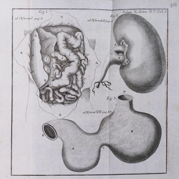 Acta physico-medica Academiae caesareae leopoldino-carolinae naturae curiosorum exhibentia ephemerides sive oservationes historias et experimenta a celeberrimis Germaniae et exterarum regionum viris habita et communicata..