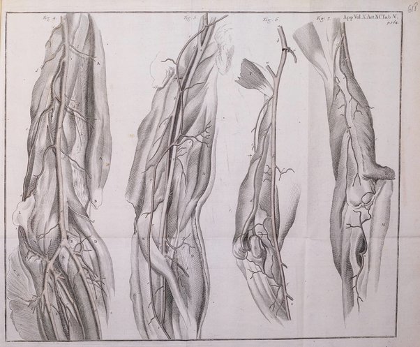 Acta physico-medica Academiae caesareae leopoldino-carolinae naturae curiosorum exhibentia ephemerides sive oservationes historias et experimenta a celeberrimis Germaniae et exterarum regionum viris habita et communicata..