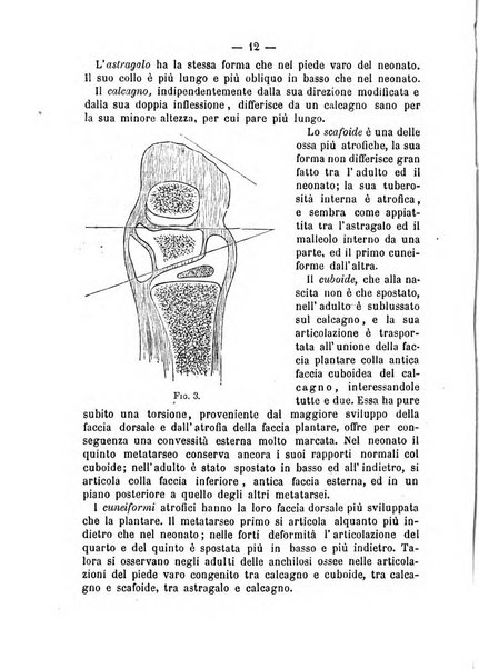 Archivio di ortopedia pubblicazione ufficiale del Pio istituto dei rachitici <1924-1950>