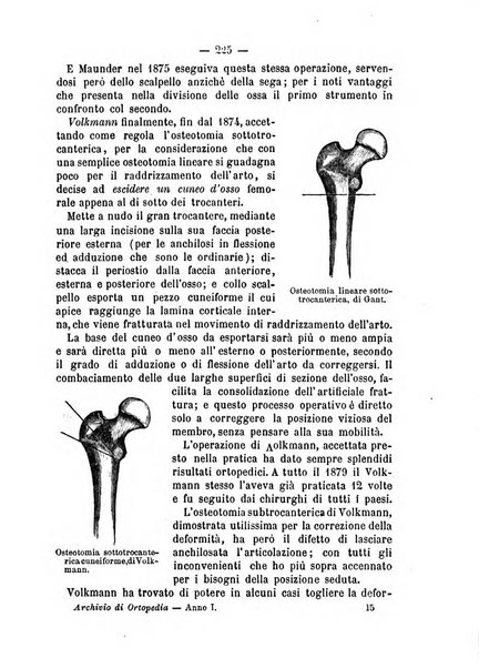 Archivio di ortopedia pubblicazione ufficiale del Pio istituto dei rachitici <1924-1950>