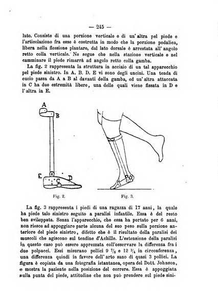 Archivio di ortopedia pubblicazione ufficiale del Pio istituto dei rachitici <1924-1950>