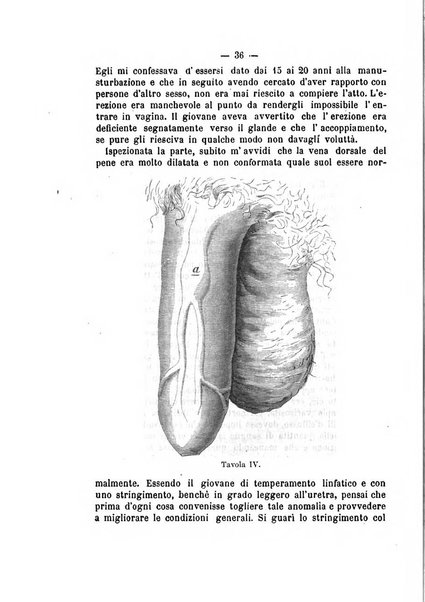 Archivio di ortopedia pubblicazione ufficiale del Pio istituto dei rachitici <1924-1950>