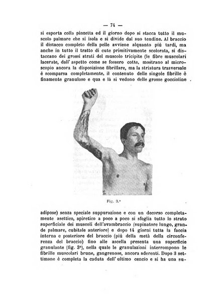 Archivio di ortopedia pubblicazione ufficiale del Pio istituto dei rachitici <1924-1950>