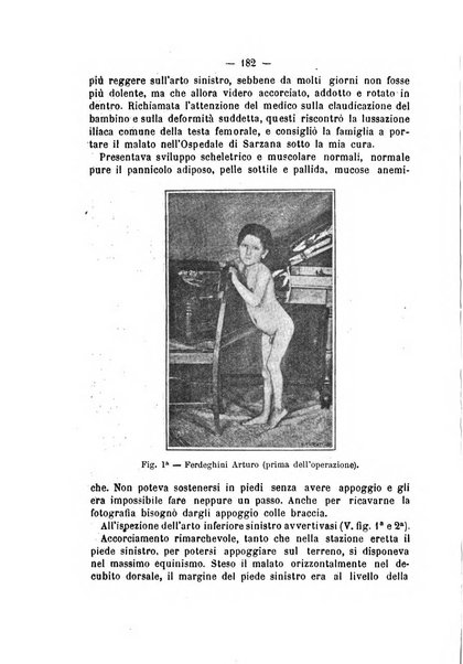 Archivio di ortopedia pubblicazione ufficiale del Pio istituto dei rachitici <1924-1950>