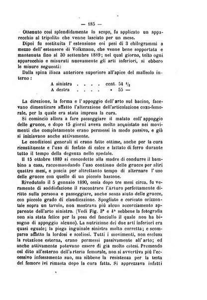 Archivio di ortopedia pubblicazione ufficiale del Pio istituto dei rachitici <1924-1950>