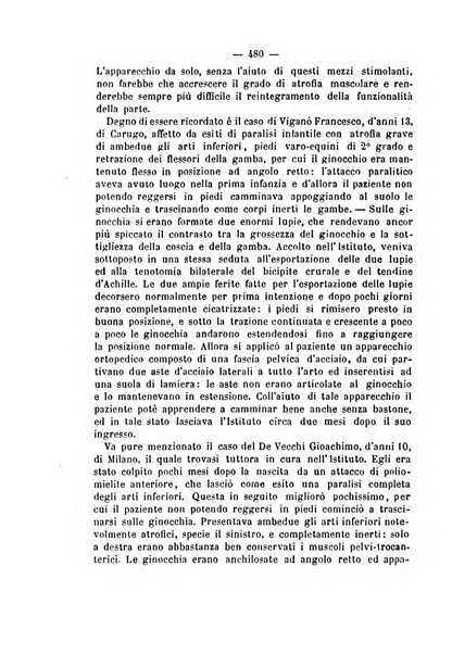 Archivio di ortopedia pubblicazione ufficiale del Pio istituto dei rachitici <1924-1950>