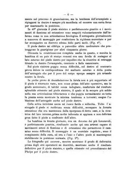 Archivio di ortopedia pubblicazione ufficiale del Pio istituto dei rachitici <1924-1950>