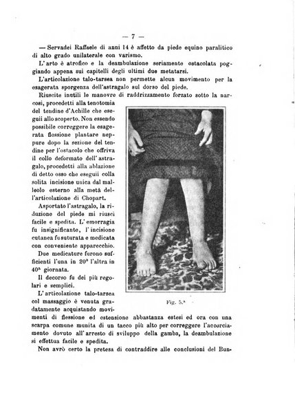 Archivio di ortopedia pubblicazione ufficiale del Pio istituto dei rachitici <1924-1950>