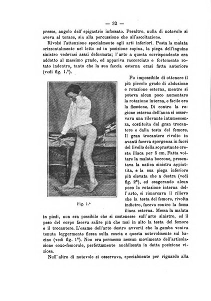 Archivio di ortopedia pubblicazione ufficiale del Pio istituto dei rachitici <1924-1950>