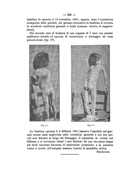 Archivio di ortopedia pubblicazione ufficiale del Pio istituto dei rachitici <1924-1950>