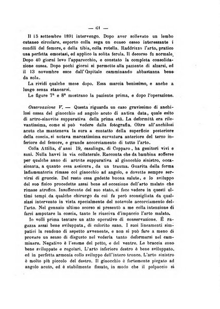 Archivio di ortopedia pubblicazione ufficiale del Pio istituto dei rachitici <1924-1950>