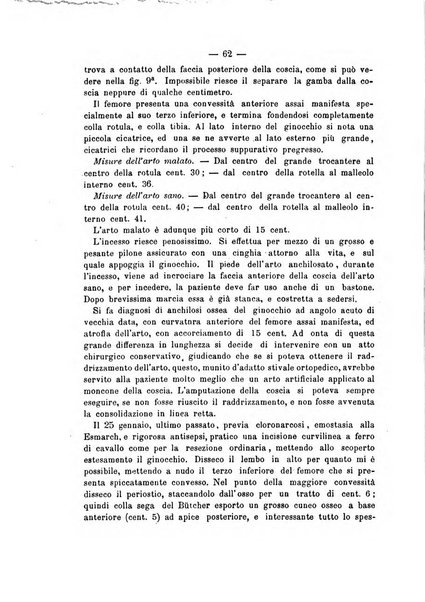 Archivio di ortopedia pubblicazione ufficiale del Pio istituto dei rachitici <1924-1950>