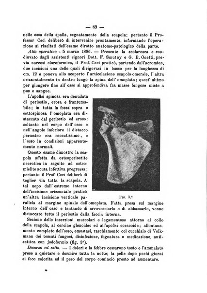 Archivio di ortopedia pubblicazione ufficiale del Pio istituto dei rachitici <1924-1950>