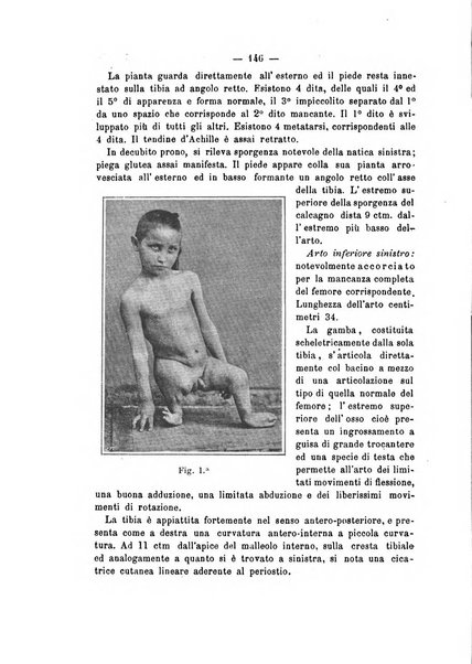 Archivio di ortopedia pubblicazione ufficiale del Pio istituto dei rachitici <1924-1950>