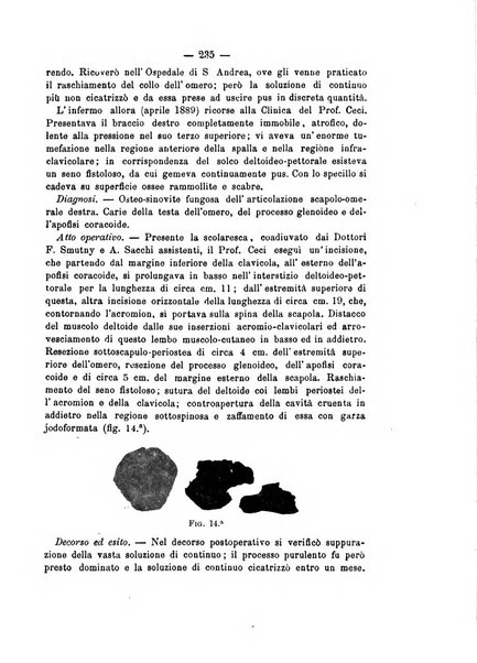 Archivio di ortopedia pubblicazione ufficiale del Pio istituto dei rachitici <1924-1950>