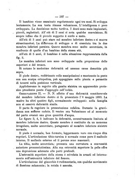 Archivio di ortopedia pubblicazione ufficiale del Pio istituto dei rachitici <1924-1950>