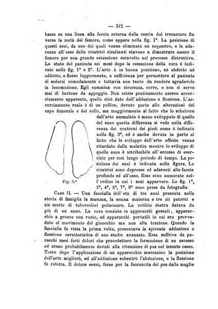 Archivio di ortopedia pubblicazione ufficiale del Pio istituto dei rachitici <1924-1950>