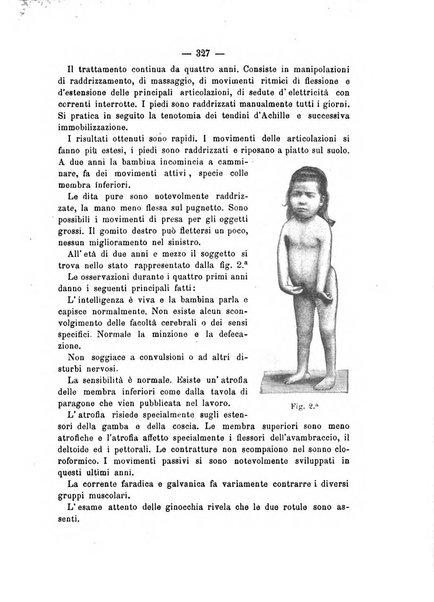 Archivio di ortopedia pubblicazione ufficiale del Pio istituto dei rachitici <1924-1950>