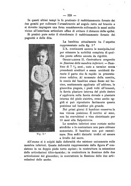 Archivio di ortopedia pubblicazione ufficiale del Pio istituto dei rachitici <1924-1950>