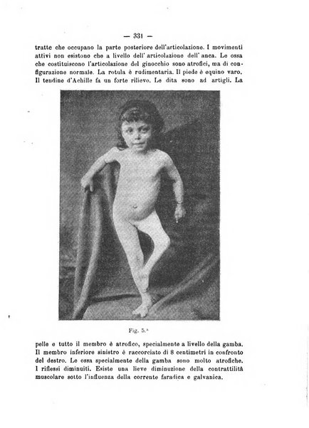 Archivio di ortopedia pubblicazione ufficiale del Pio istituto dei rachitici <1924-1950>