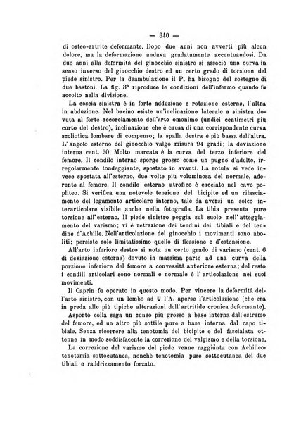 Archivio di ortopedia pubblicazione ufficiale del Pio istituto dei rachitici <1924-1950>