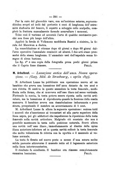 Archivio di ortopedia pubblicazione ufficiale del Pio istituto dei rachitici <1924-1950>