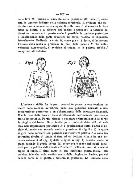 Archivio di ortopedia pubblicazione ufficiale del Pio istituto dei rachitici <1924-1950>