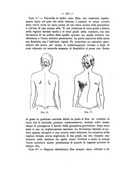 Archivio di ortopedia pubblicazione ufficiale del Pio istituto dei rachitici <1924-1950>