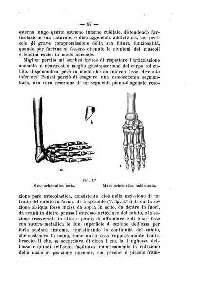 Archivio di ortopedia pubblicazione ufficiale del Pio istituto dei rachitici <1924-1950>