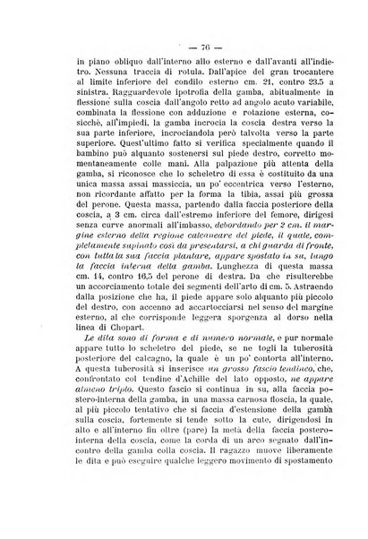 Archivio di ortopedia pubblicazione ufficiale del Pio istituto dei rachitici <1924-1950>