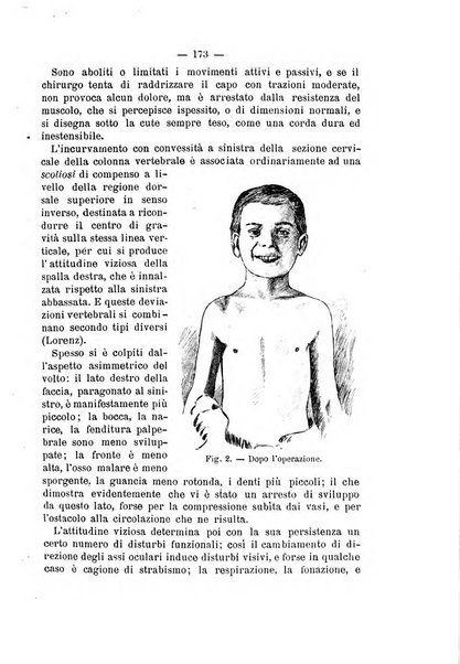 Archivio di ortopedia pubblicazione ufficiale del Pio istituto dei rachitici <1924-1950>