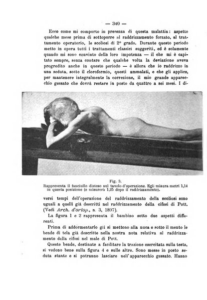 Archivio di ortopedia pubblicazione ufficiale del Pio istituto dei rachitici <1924-1950>