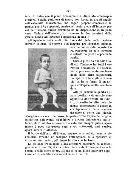 Archivio di ortopedia pubblicazione ufficiale del Pio istituto dei rachitici <1924-1950>