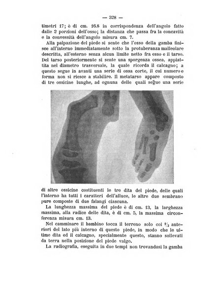 Archivio di ortopedia pubblicazione ufficiale del Pio istituto dei rachitici <1924-1950>